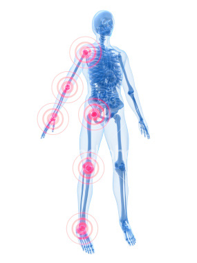 joint-inflammation