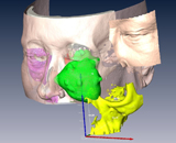 3D_facial_reconstruction