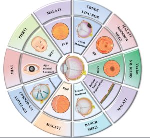 lncrnas-in-various-kinds-of-visual-impairment