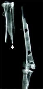 Fig 1: Plain craniocaudal radiograph of the left tibiotarsus and tarsometatarsus showing three radiodense objects (white and black arrowheads)